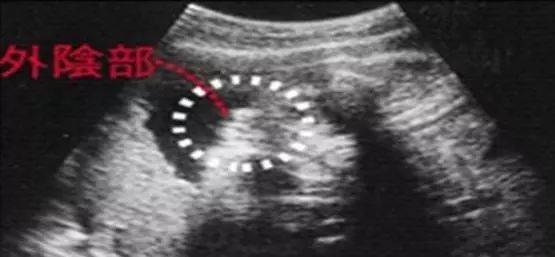 太准了!胎心看男女_胎心看男女_几周胎心看男女比较准