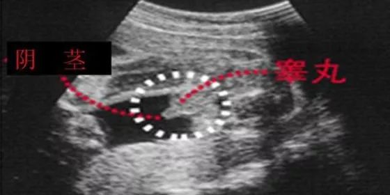 胎心看男女_太准了!胎心看男女_胎心看男女准吗