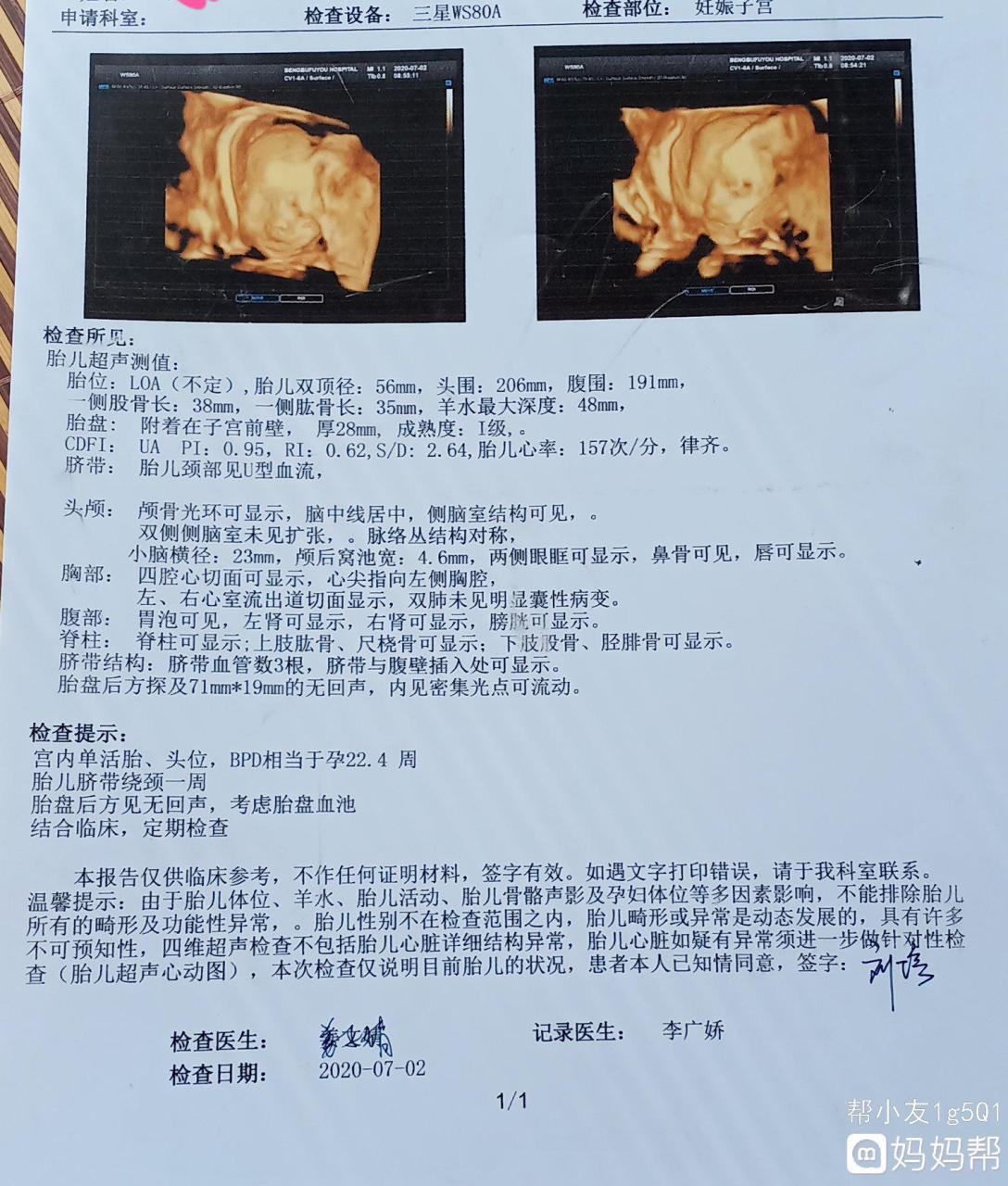 胎心看男女_胎心看男女准吗_太准了!胎心看男女