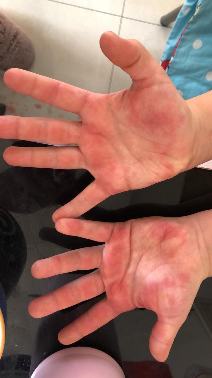 解除劳动合同和解除劳动关系的区别_深圳劳动局的劳动合同范本_劳动节