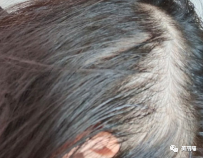 洗发水丝蕴和滋源哪个好_丝蕴洗发水_洗发水丝蕴和施华蔻哪个好用